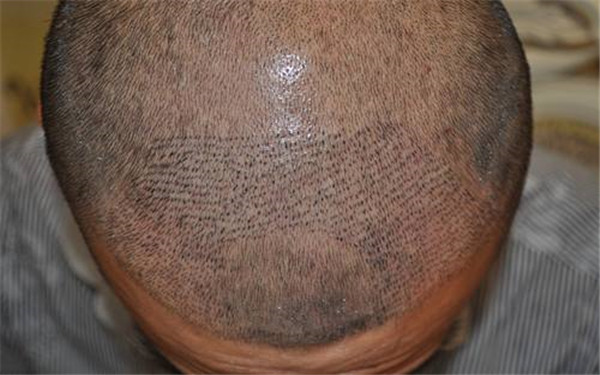 東方美萊塢、永美等四強(qiáng)醫(yī)美上榜！安徽亳州整形醫(yī)院最新匯總表公布