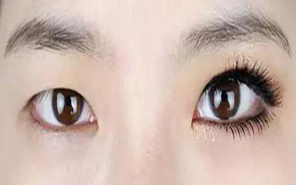 樂山整形醫(yī)院推薦：達芬奇與西嬋，你更喜歡哪一個？獲取比較結(jié)果！