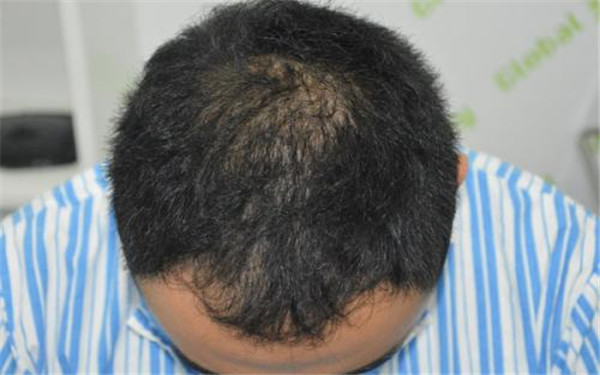 上海著名整形醫(yī)院推薦：終結(jié)疤痕困擾的好去處！