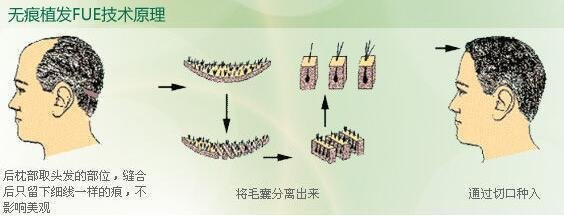 東莞最佳口腔診所盤點：解決牙齒健康問題的最佳選擇！