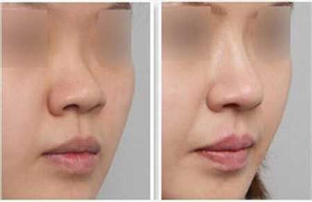 【默默篩選】北京五家高信譽(yù)的私密整形醫(yī)院