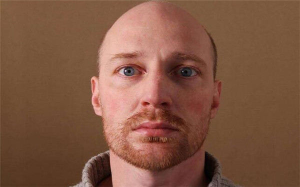 【攻略曝光】五大領軍品牌揭秘！尋找武漢最佳牙齒矯正所在的熱門名單