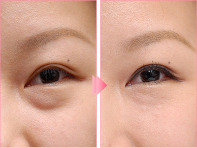 上海整形醫(yī)院最佳選擇！潔銘、伊萊美、時(shí)光、藝星等實(shí)力醫(yī)院推薦！