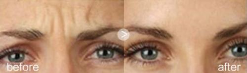 北京手指整形手術醫(yī)院推薦：頂尖機構全覆蓋，你的理想之選