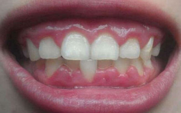 烏魯木齊注射祛除眉間紋醫(yī)生