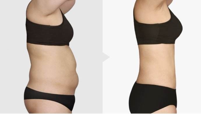 南京激光祛斑?？漆t(yī)院一覽：綜合實力強大，安心選擇！