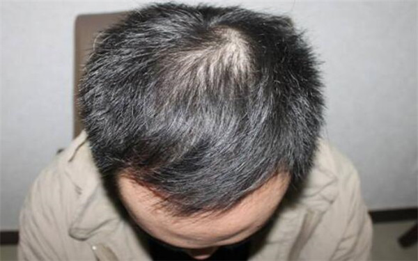 南昌三甲醫(yī)院全面盤(pán)點(diǎn)：專業(yè)美容整形醫(yī)院推薦，趕緊了解一下！