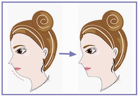 蘭州整形醫(yī)院排行榜出爐！選擇最滿意的吸脂抽脂醫(yī)院！