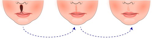 北京種植牙專(zhuān)家團(tuán)隊(duì)超卓，醫(yī)院名列前茅！