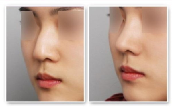 南京紋身去除醫(yī)院大全：幫助您恢復(fù)光滑肌膚的專業(yè)機(jī)構(gòu)！