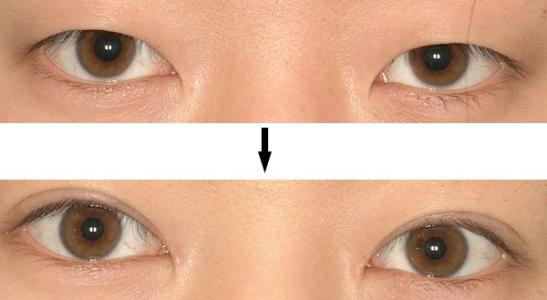 廈門哪家三甲整形醫(yī)院口碑最好？大揭秘，公立還是私立更值得信賴！