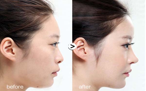 北京眼袋手術醫(yī)院匯總：前五強推薦，不容錯過！