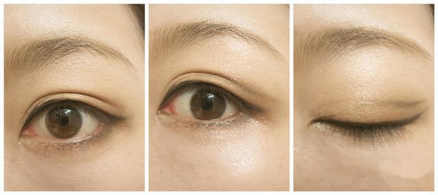 北京治療眼袋效果最好的公立醫(yī)院排行榜發(fā)布！頂級醫(yī)療機構全在列