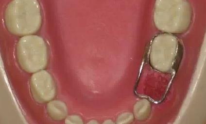 保定整形醫(yī)院雙眼皮割刀痕排行榜揭曉！丨華美、藍山哪家更受保定人喜愛？