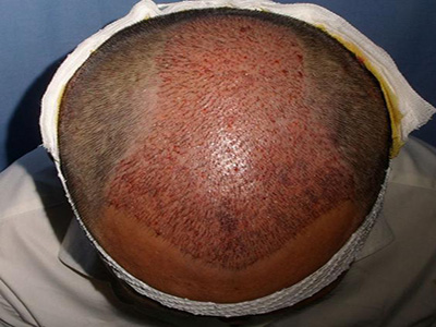 南京優(yōu)秀的合法醫(yī)學(xué)美容醫(yī)院推薦！當(dāng)?shù)貦?quán)威整形機構(gòu)品質(zhì)保障~