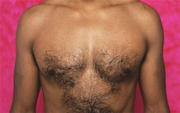 北京哪家醫(yī)院祛斑效果最好？匯總5家頂級醫(yī)院供參考！附最新價目表揭曉！