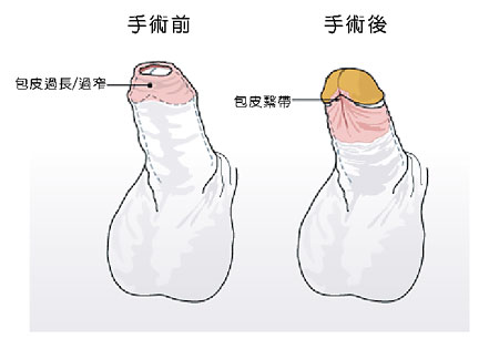 南京哪家醫(yī)院矯正牙齒比較好？推薦貝鶴雅康、美奧、貝芽、卡瓦、藍鱘等！