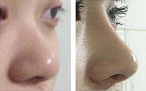 北京頂級(jí)整形醫(yī)生盤(pán)點(diǎn)：無(wú)人不知的9位專(zhuān)業(yè)大咖，技術(shù)精湛過(guò)人！