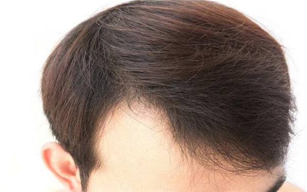 廣州整形醫(yī)院綜合指南：不可錯過的醫(yī)美中心全解析！