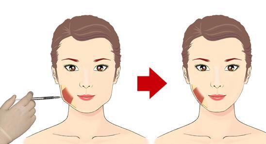 宿遷祛斑美容醫(yī)院綜合評(píng)價(jià)前六靠譜推薦：奕美無(wú)疑達(dá)標(biāo)