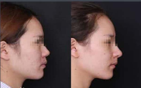 天津美容科醫(yī)院匯總前五，公立機(jī)構(gòu)解決方案公開！