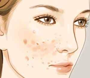 廣州植發(fā)醫(yī)院TOP7匯總-公立、私立對(duì)比及口碑分享，前三口碑極佳，性價(jià)比超高！