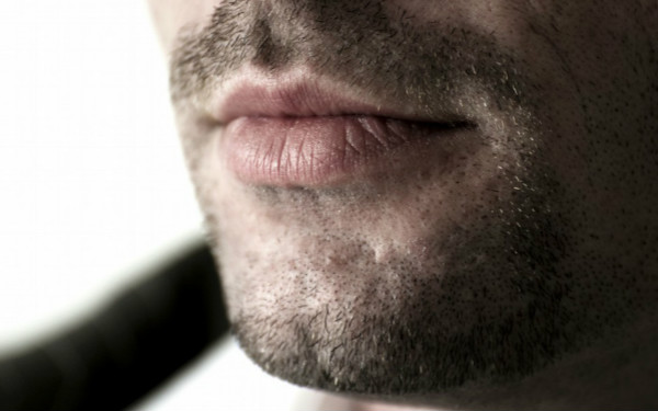 嘉興祛斑醫(yī)院推薦排行榜，藝星醫(yī)療和曙光皮膚?？颇募腋孔V？