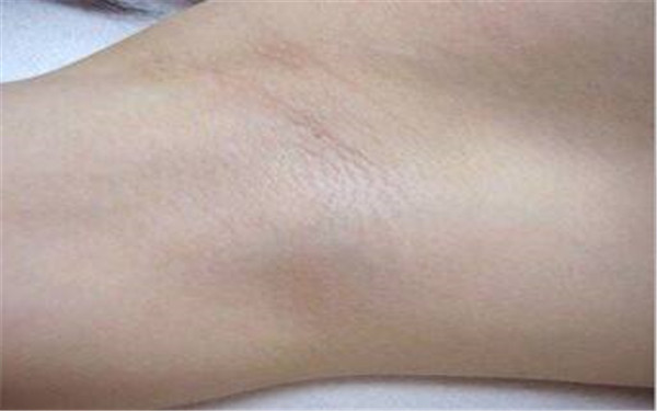 常州去眼袋手術(shù)醫(yī)院評價(jià)推薦 頂級醫(yī)院排行榜全新披露