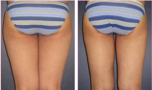 天津治療疤痕疙瘩醫(yī)院排行榜：文怡、坤如瑪麗引人矚目！