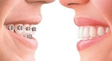 大連地區(qū)脫發(fā)問(wèn)題加?。空业胶线m植發(fā)醫(yī)院，解決困擾！