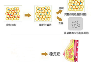 哪位醫(yī)生在八大處做雙眼皮效果最好？最受歡迎的五個口碑推薦！勢頭強勁！
