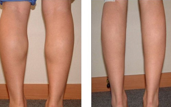 廣州隆鼻美容醫(yī)院排行榜：公立vs私立，隆鼻專家詳細解析