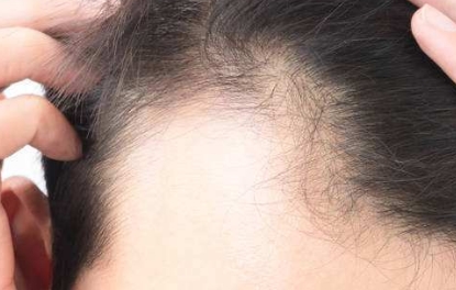 國(guó)內(nèi)頂級(jí)面部脂肪填充醫(yī)院盤(pán)點(diǎn)：頂尖專業(yè)團(tuán)隊(duì)，選擇一定不后悔！