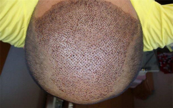 哪家重慶整形醫(yī)院下頜角手術(shù)口碑不錯(cuò)？【5家權(quán)威機(jī)構(gòu)對(duì)比】