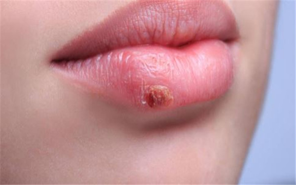 成都祛眶下皺紋醫(yī)生