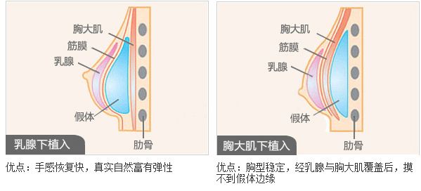 宜賓最佳雙眼皮整形醫(yī)院推薦！這七家美容院你絕不能錯(cuò)過