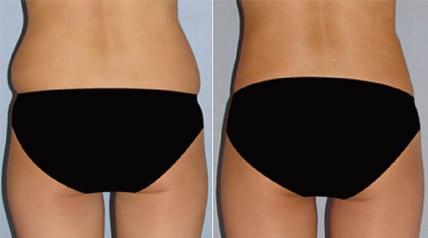 成都最受好評的整形醫(yī)院匯總，專業(yè)拉皮手術效果一流