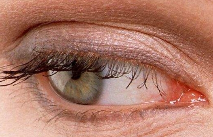 杭州哪家眼部整形醫(yī)院比較靠譜？浙江雙眼皮整形醫(yī)院排行榜TOP7！