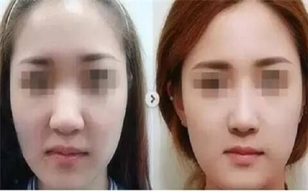 杭州最受歡迎的整形醫(yī)院推薦！匯總市場口碑最好的八家醫(yī)美機(jī)構(gòu)，綜合評價超乎想象，專業(yè)水平極高！