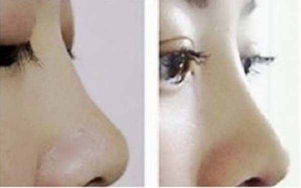 揭秘深圳三家知名整容機構，助你尋找信賴的美容醫(yī)院