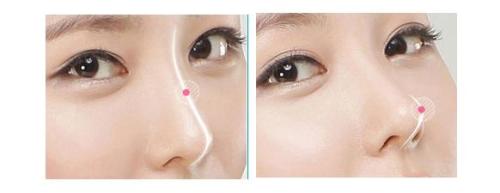 揭秘西安豐胸三甲醫(yī)院專家評(píng)選！西京、唐都脫穎而出，實(shí)力堪比五強(qiáng)！