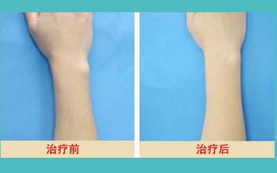 最新發(fā)布！匯總?cè)箩t(yī)院名單，解決牙齒問題待了整整一年