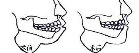 提供重慶哪家私立醫(yī)院割雙眼皮好？前五推薦_軍美領(lǐng)先，再揭秘