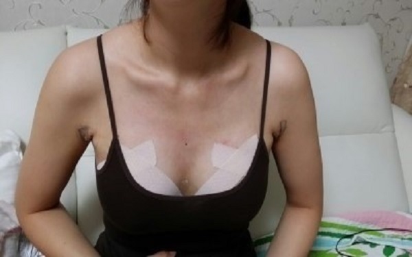 揭秘！東營2023年頂尖隆胸醫(yī)院匯總出爐，排名前十強！