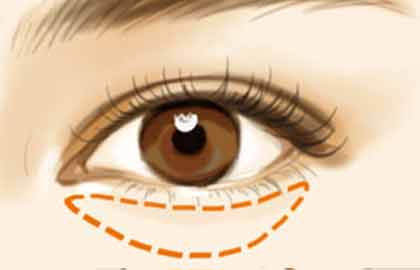 懷化哪家醫(yī)院做臉部脂肪填充效果好？2023年價目表全知道，去評價最好的六家吧！