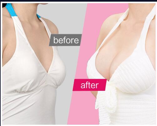 惠州市的頂尖整容整形醫(yī)院排行榜發(fā)布，時光演變伊麗莎白變得更加耀眼了！