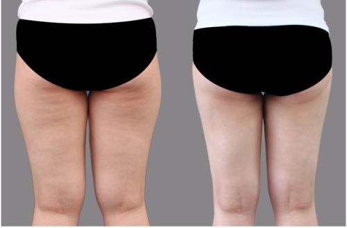 廣西整形醫(yī)院精選！當(dāng)紅top6醫(yī)院名單曝光，人氣首選聚焦簡(jiǎn)介