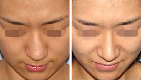 杭州磨骨(下頜角)整形頂級醫(yī)療設施匯總前五