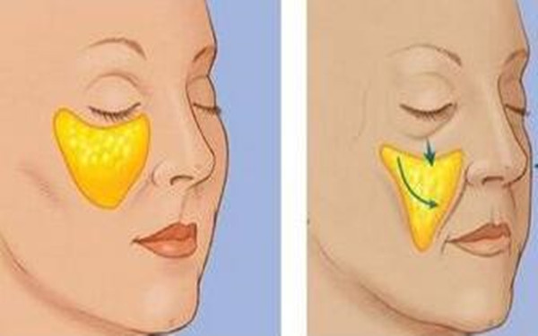 揭秘四川地區(qū)優(yōu)質(zhì)隆鼻醫(yī)院Top4，大多為公立醫(yī)療機(jī)構(gòu)！