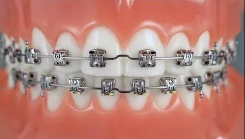 昆明頂級(jí)牙科醫(yī)院排行榜出爐！整牙專(zhuān)家力壓群雄，技術(shù)高超